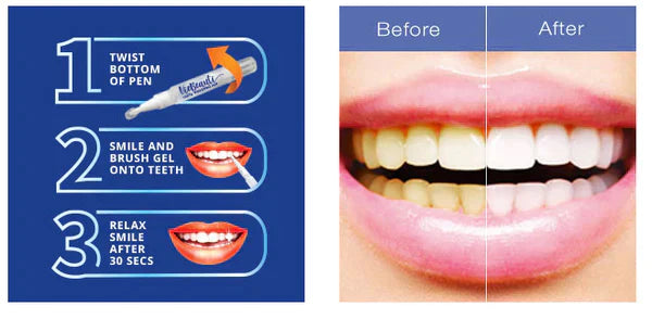 Teeth Whitening Pen